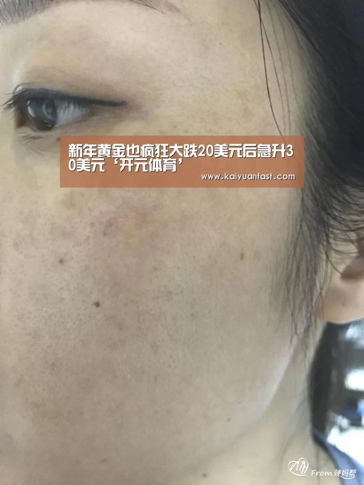 新年黄金也疯狂大跌20美元后急升30美元‘开元体育’(图1) 开元热点